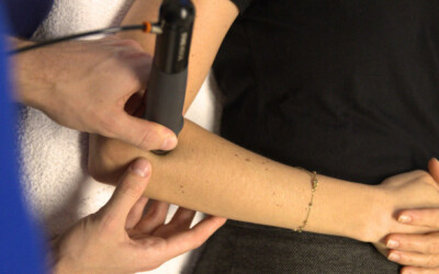 Les ondes de choc en physiothérapie