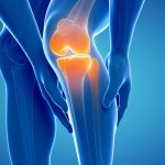 Knee-pain-56ddd0b25f9b5854a9f62098