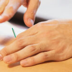 bandeau-dry-needling-header